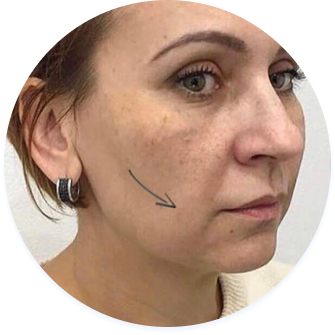 face before